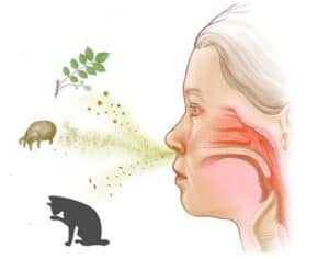 What are allergies? What are allergies?