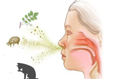 Allergy